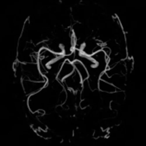 CT Brain Plain at Ayucare Diagnostic Center