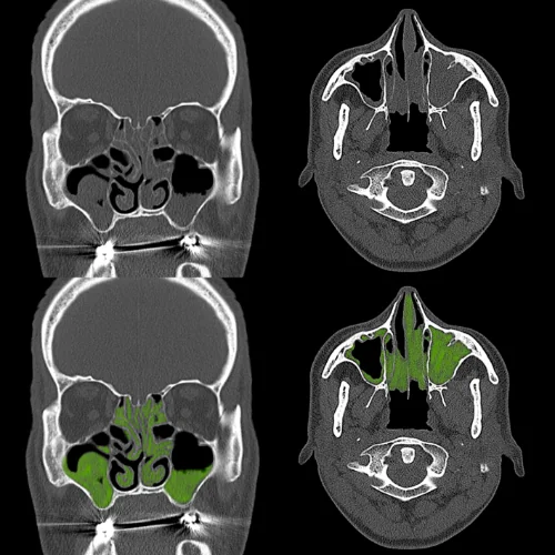 MRCP scan at Ayucare Diagnostic Center