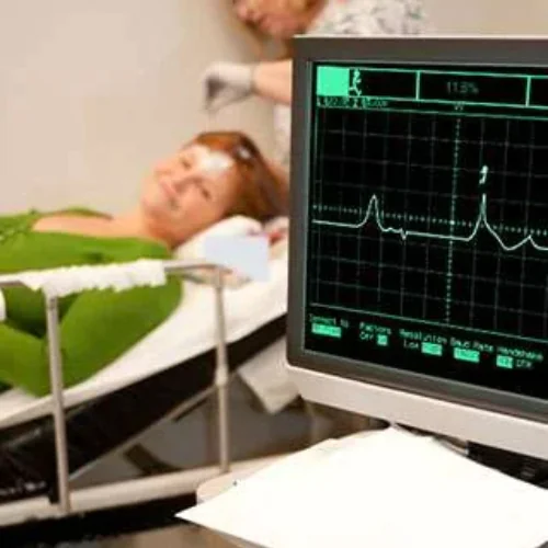 ECG Test at Ayucare Diagnostic Center