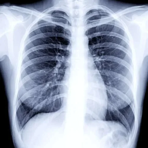 X-Ray at Ayucare Diagnostic Center